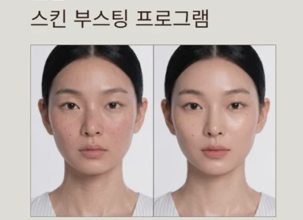 온실 복합 초음파 리프팅 ㅣ 울쎄라 + 튠라이너